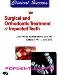 Clinical Success in Surgical and Orthodontic Treatment of Impacted Teeth (pdf)